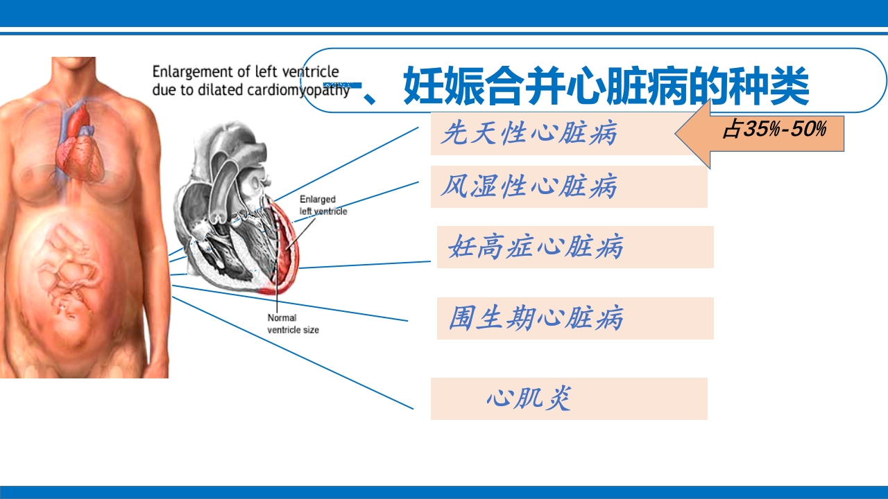 妊娠合并心脏病ppt课件3