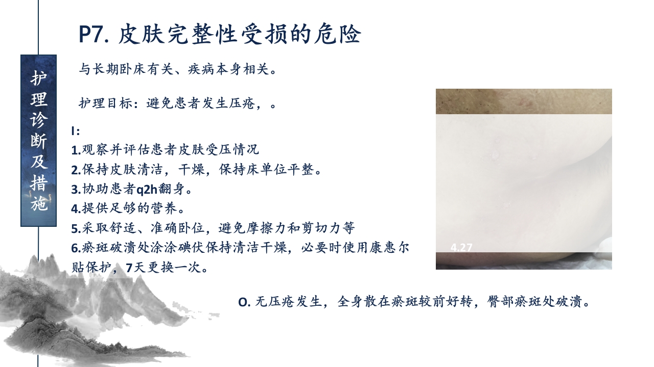 一例ANCA相关性血管炎患者的护理查房ppt课件58