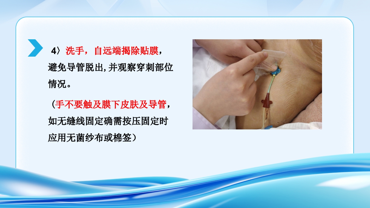 PICC CVC 输液港使用及维护ppt课件14