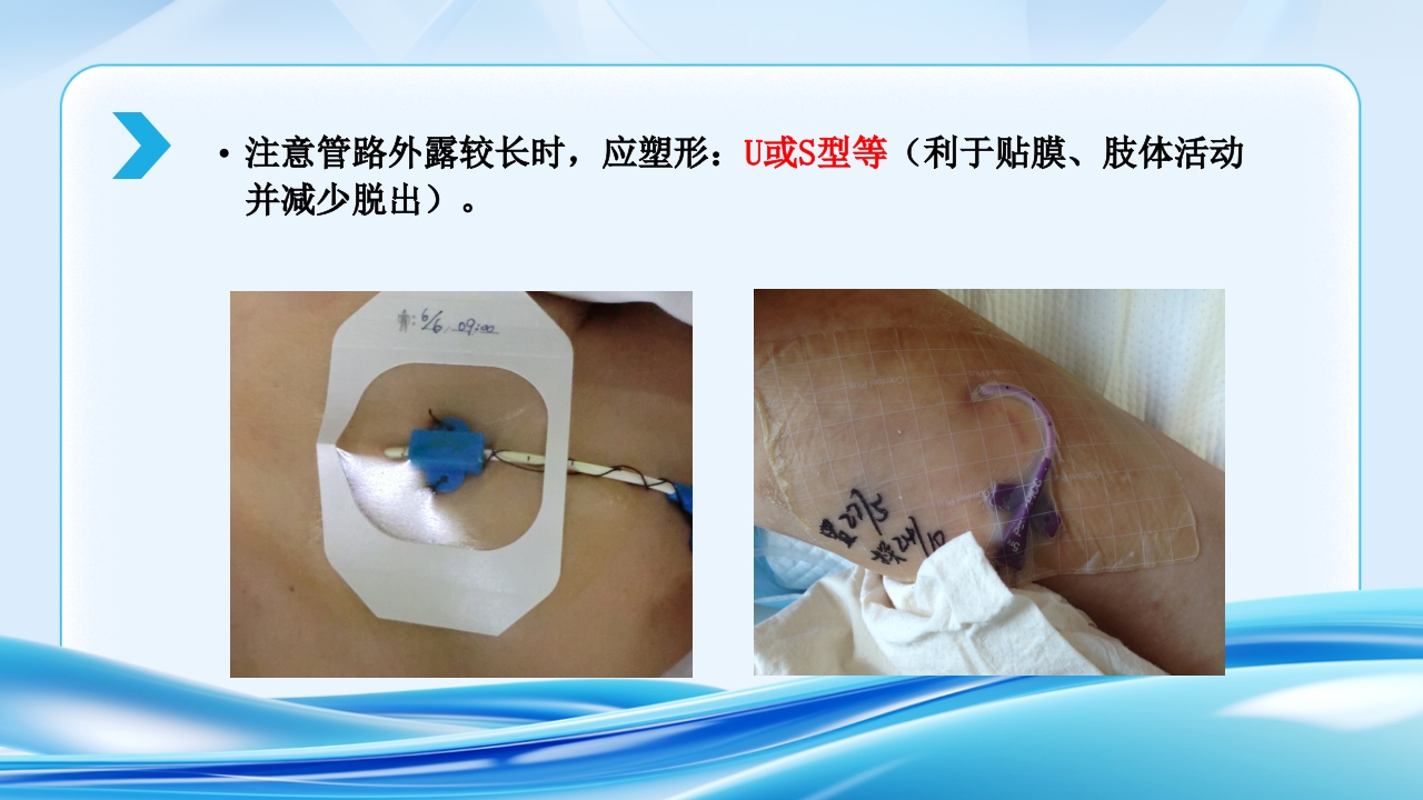 PICC CVC 输液港使用及维护ppt课件18