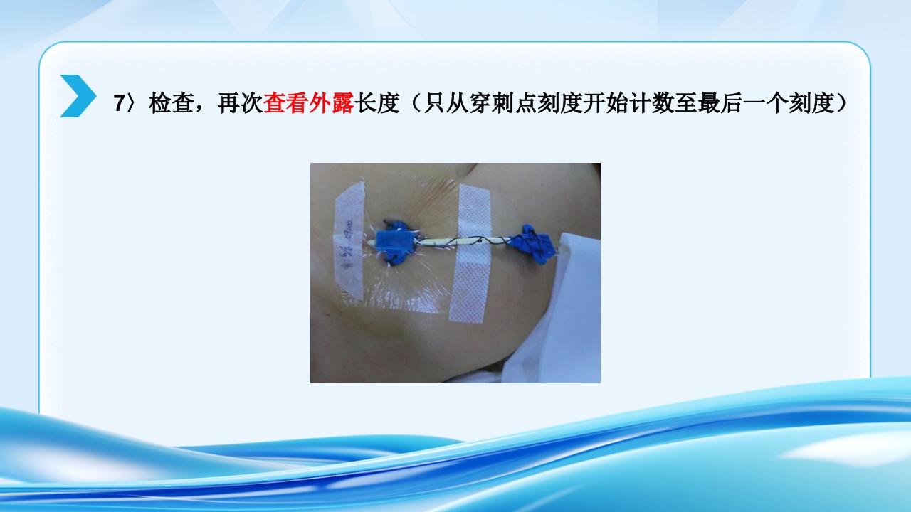 PICC CVC 输液港使用及维护ppt课件19