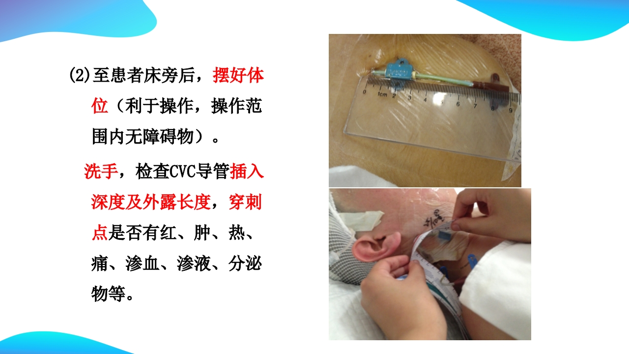 CVC维护ppt课件15