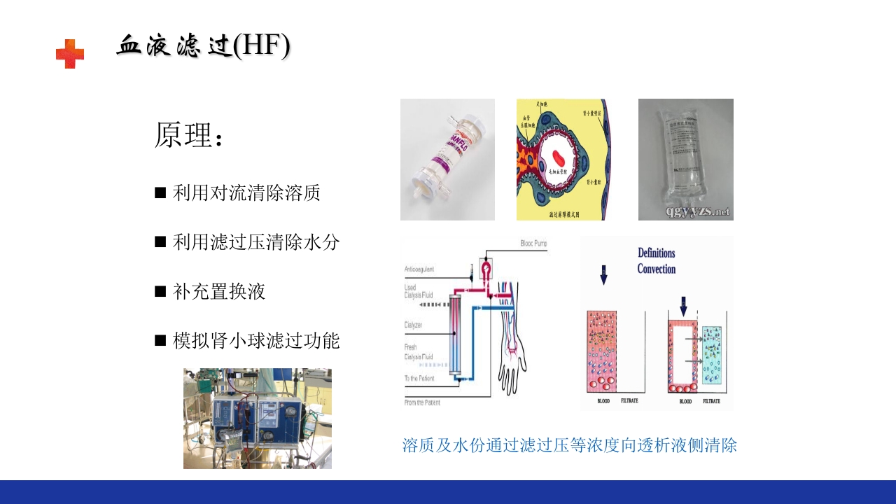 危重患者的血液净化ppt课件13