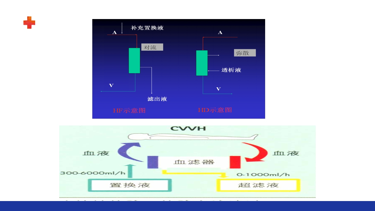 危重患者的血液净化ppt课件14