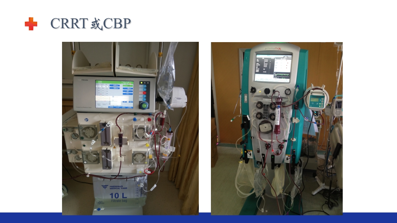 危重患者的血液净化ppt课件27