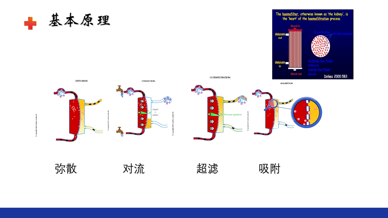 危重患者的血液净化ppt课件6