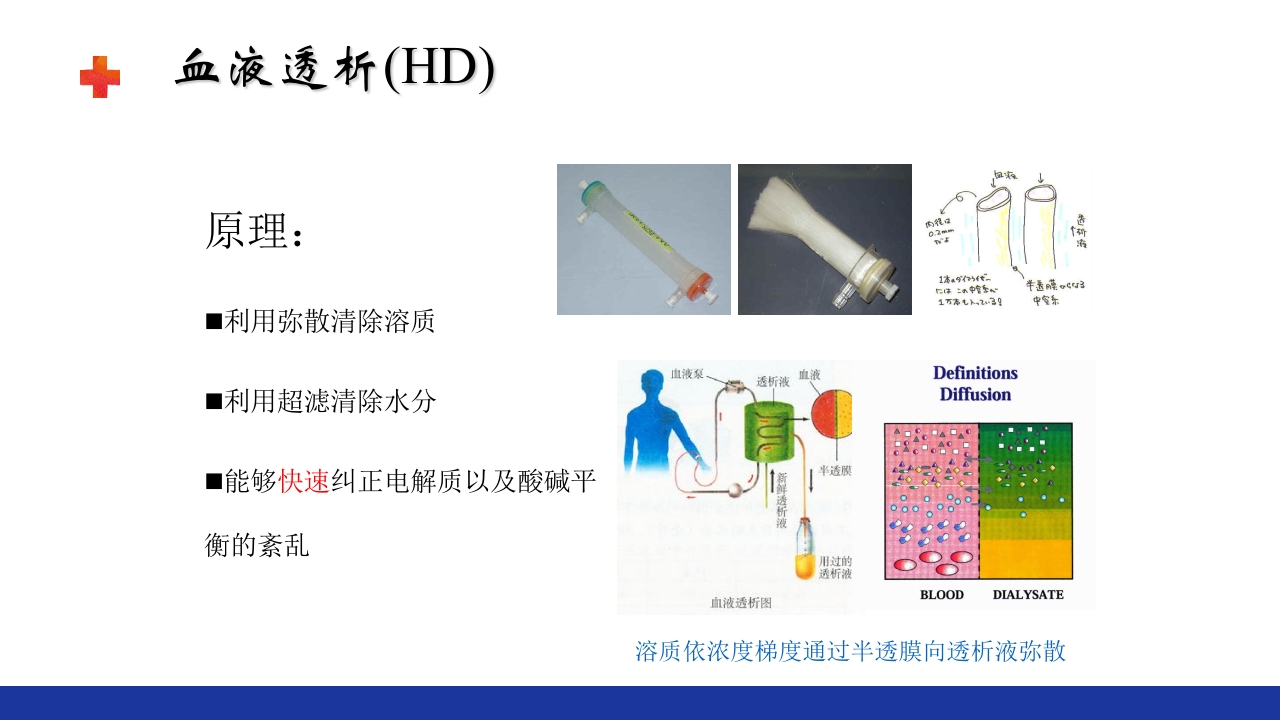 危重患者的血液净化ppt课件8