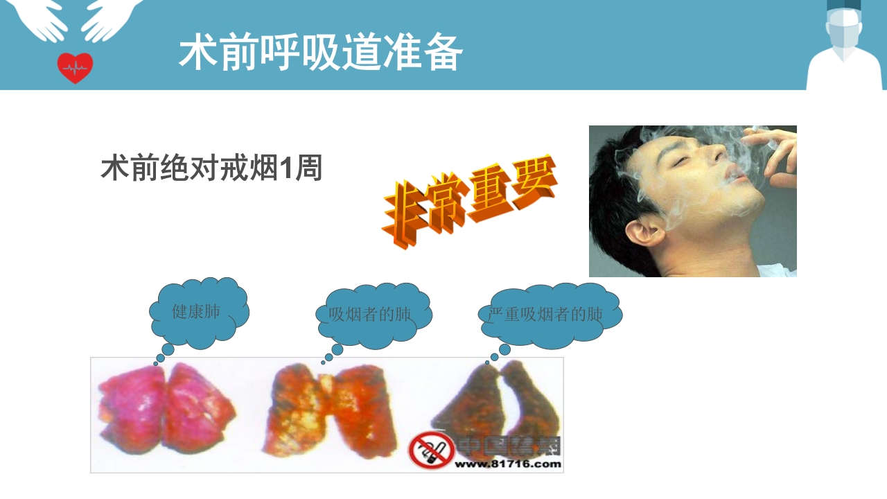 肺癌患者围手术期呼吸道管理ppt课件12