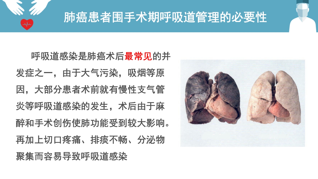 肺癌患者围手术期呼吸道管理ppt课件6