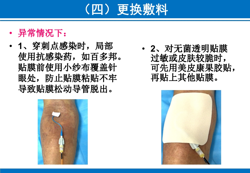 PICC与CVC的日常维护ppt课件33
