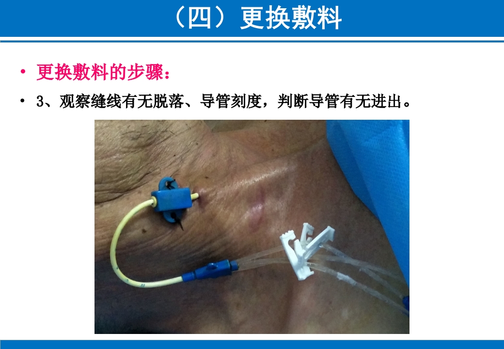 PICC与CVC的日常维护ppt课件57