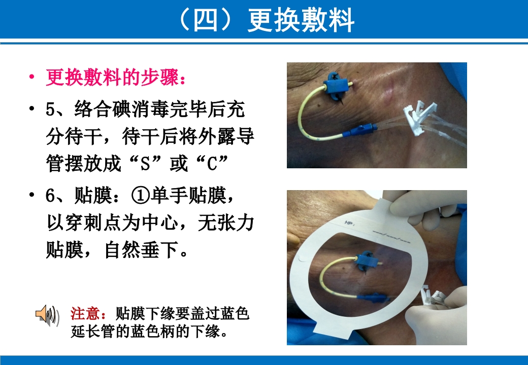 PICC与CVC的日常维护ppt课件59