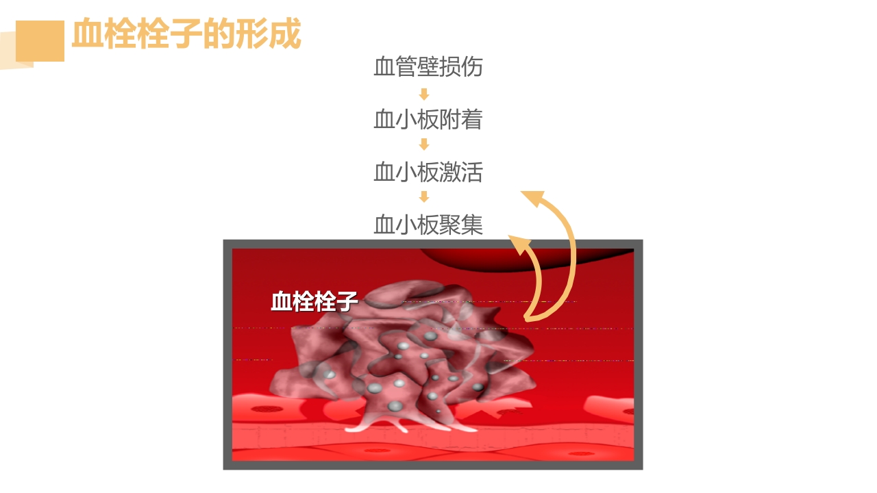 急性脑梗死的溶栓及抗栓治疗PPT课件35