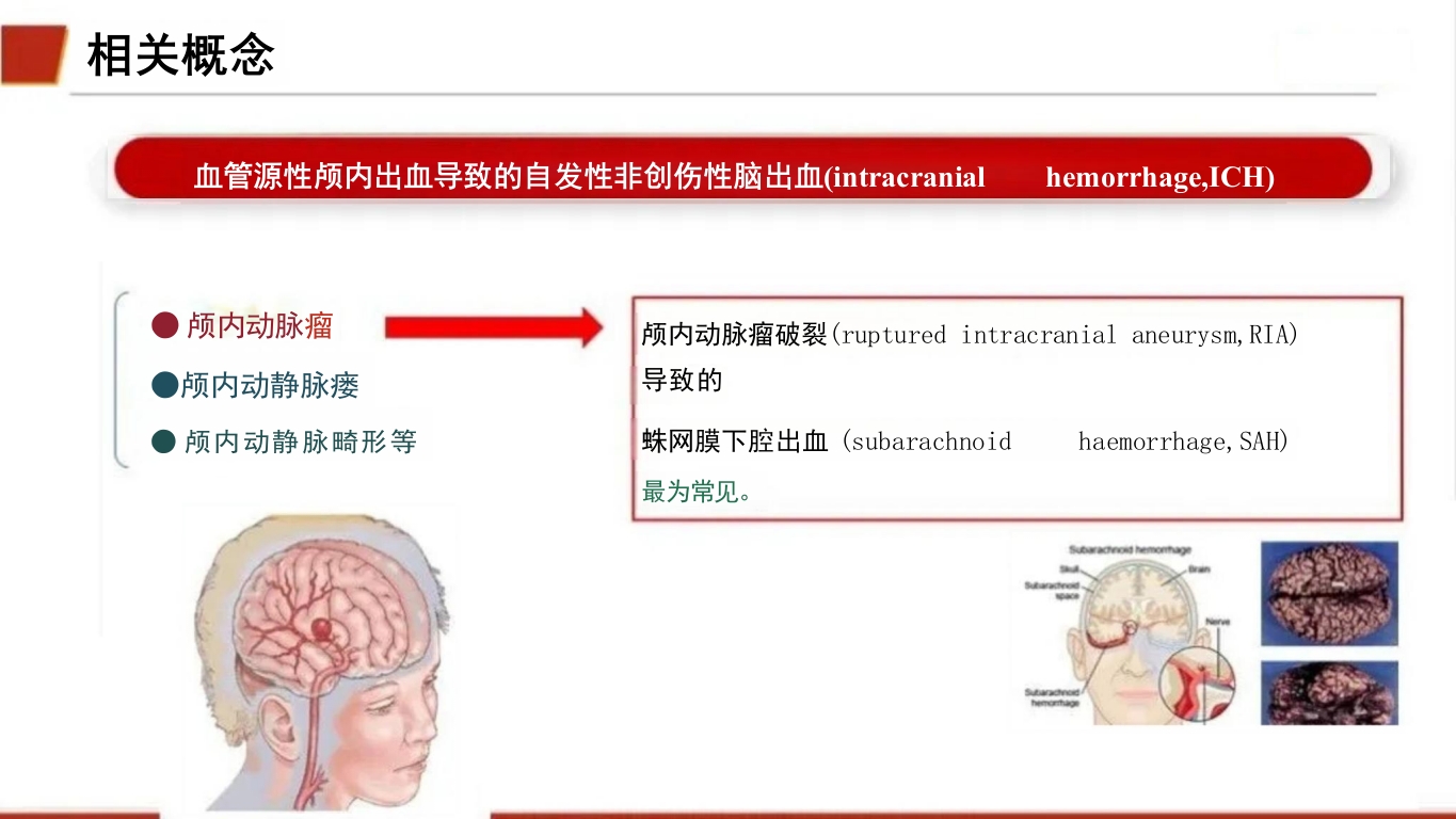 临床颅内动脉瘤破裂伴蛛网膜下腔出血的个案护理10