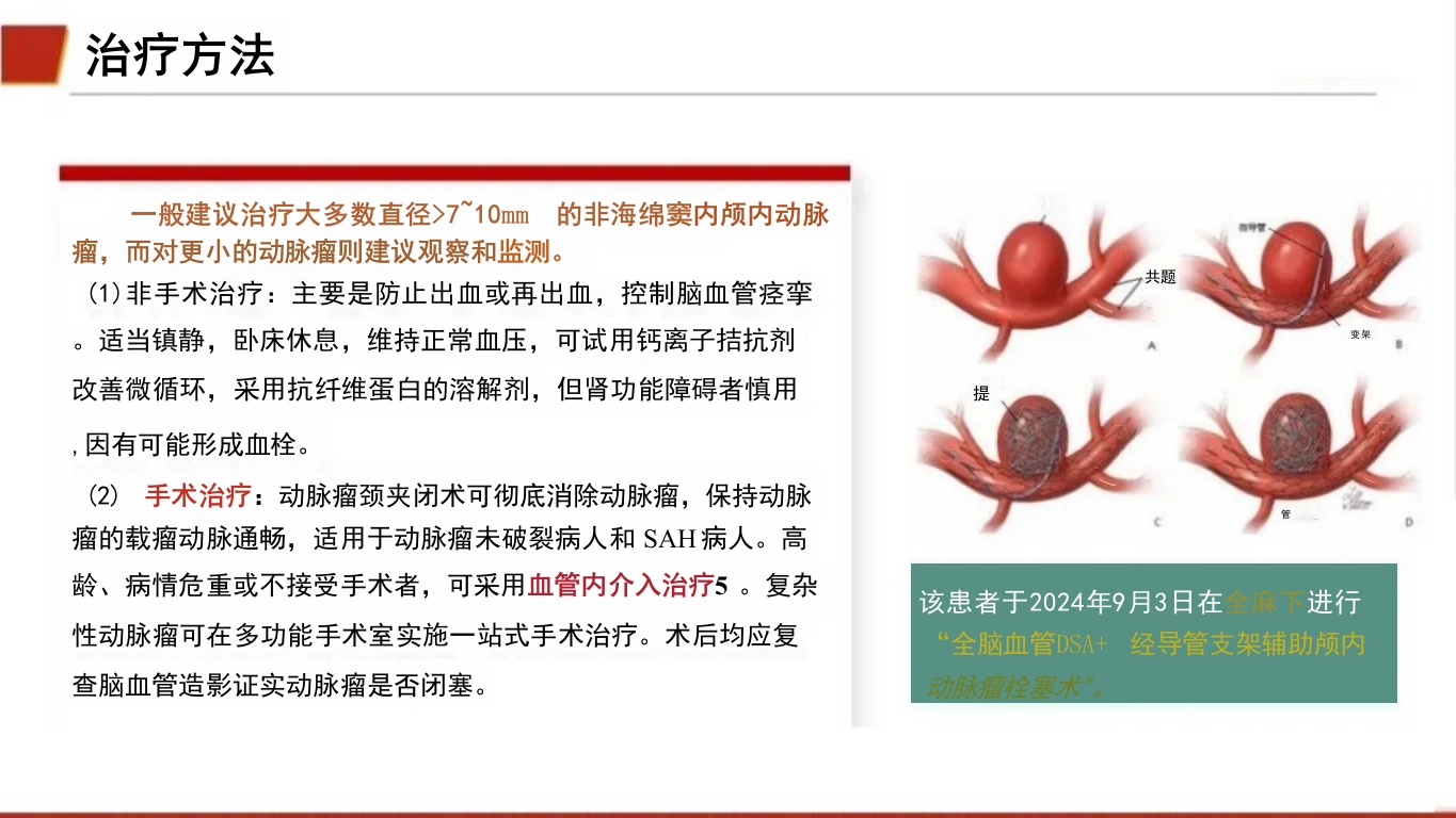 临床颅内动脉瘤破裂伴蛛网膜下腔出血的个案护理22