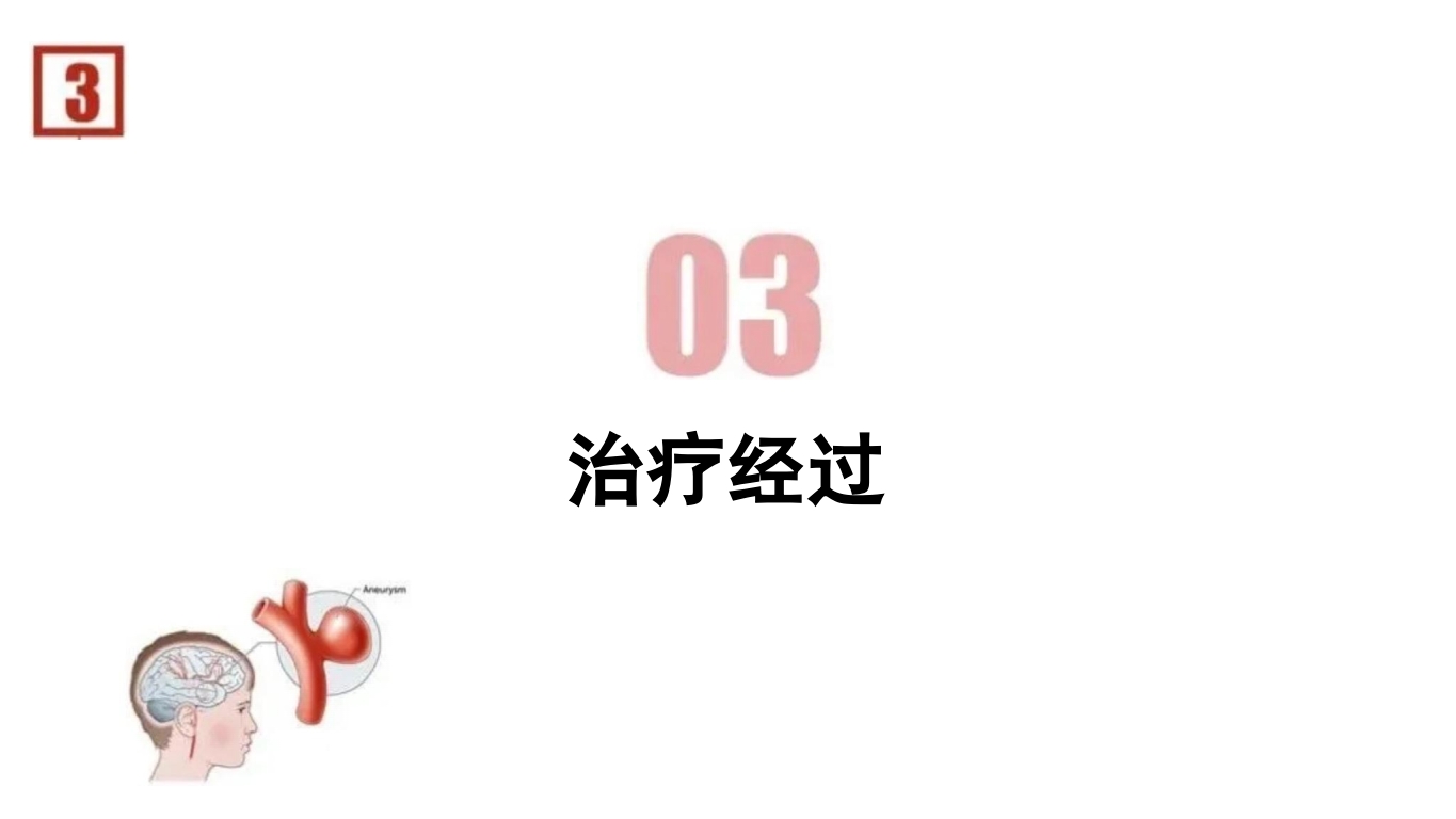 临床颅内动脉瘤破裂伴蛛网膜下腔出血的个案护理23