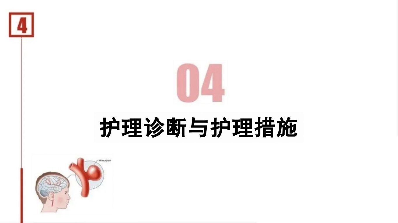 临床颅内动脉瘤破裂伴蛛网膜下腔出血的个案护理28