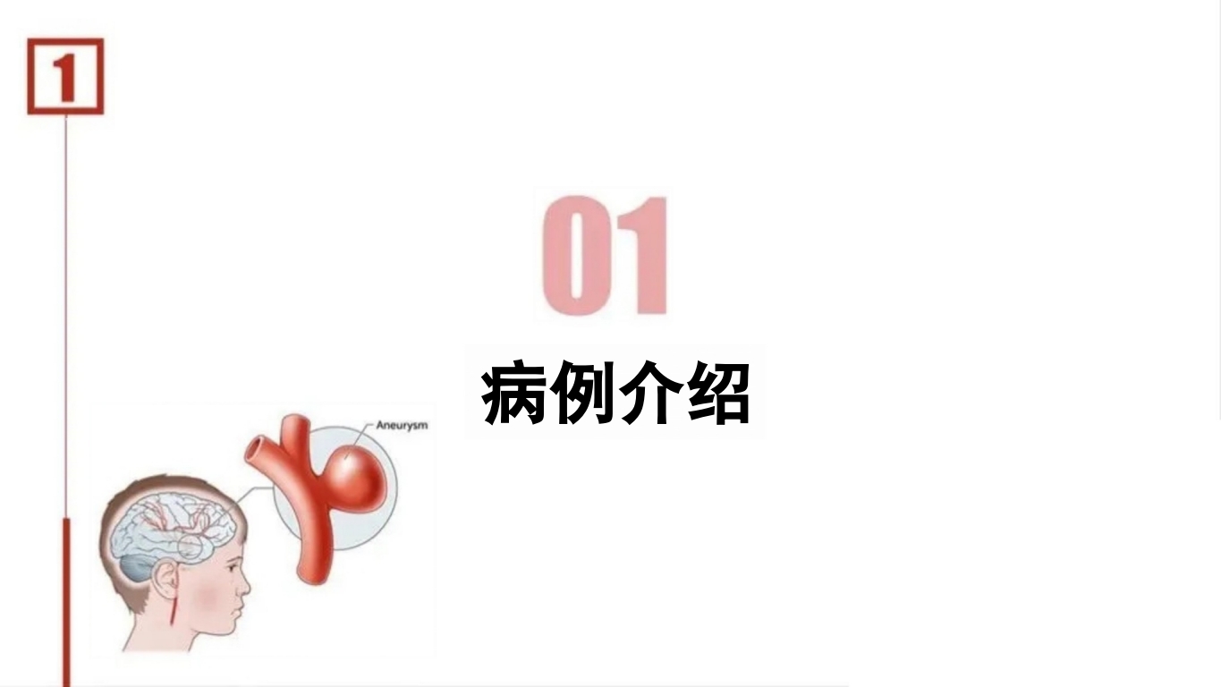 临床颅内动脉瘤破裂伴蛛网膜下腔出血的个案护理3