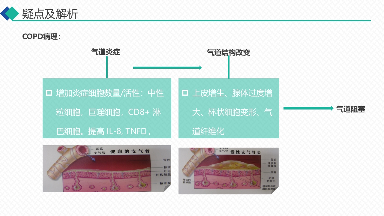 9000无创呼吸机通气治疗慢阻肺合并呼吸衰竭的护理PPT课件9