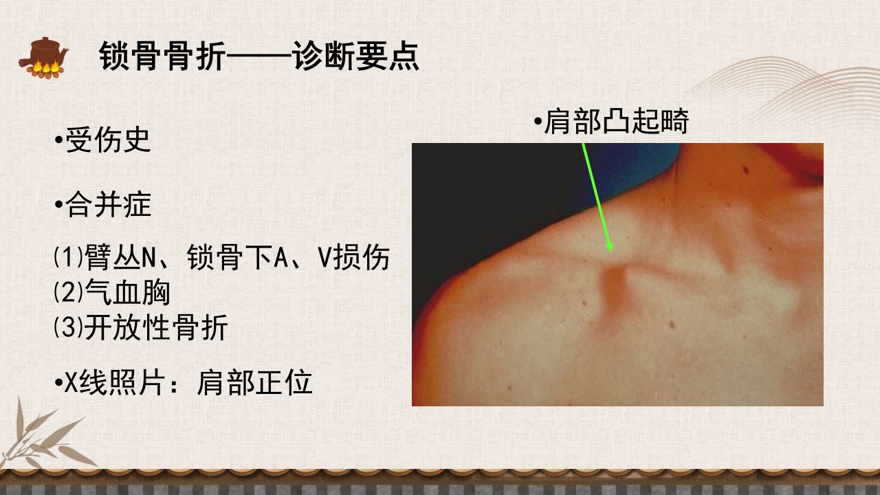 中医伤科上肢骨折护理查房PPT课件10