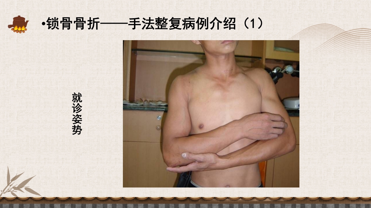 中医伤科上肢骨折护理查房PPT课件14