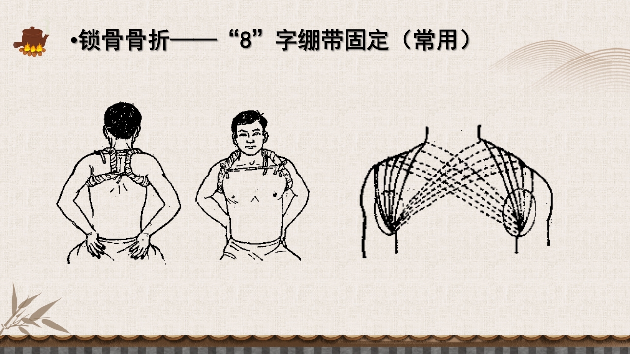 中医伤科上肢骨折护理查房PPT课件19