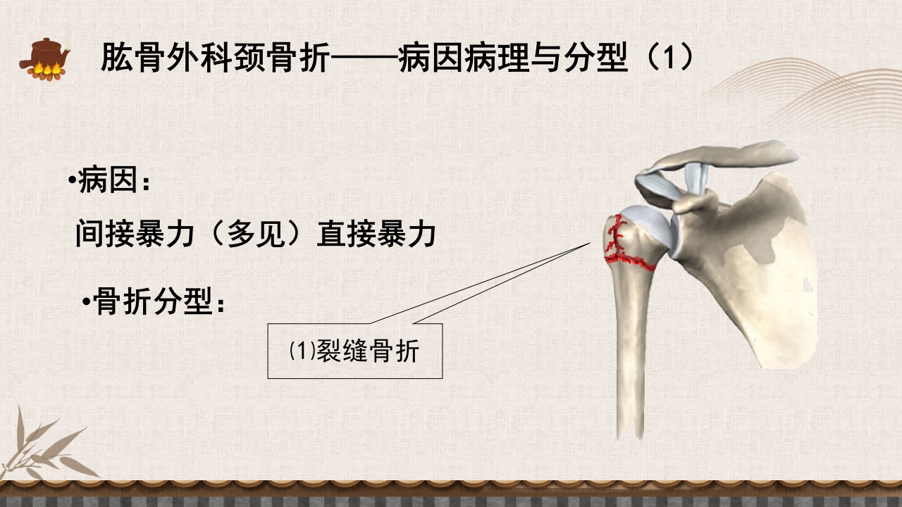中医伤科上肢骨折护理查房PPT课件25