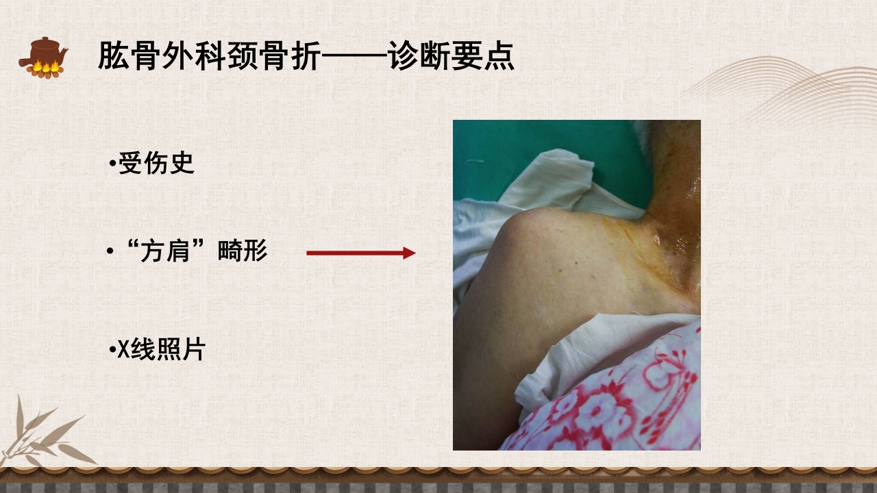 中医伤科上肢骨折护理查房PPT课件29