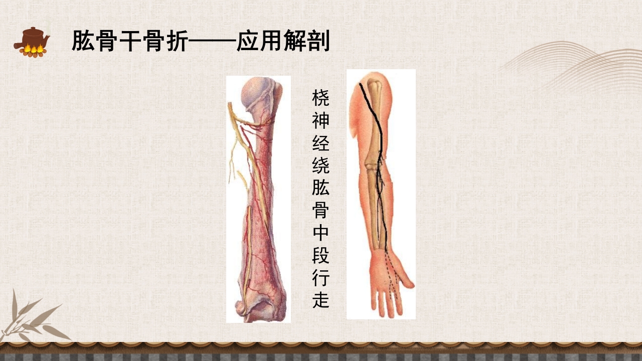 中医伤科上肢骨折护理查房PPT课件41