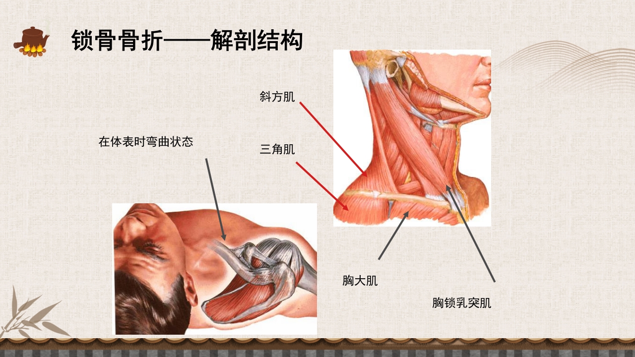 中医伤科上肢骨折护理查房PPT课件7