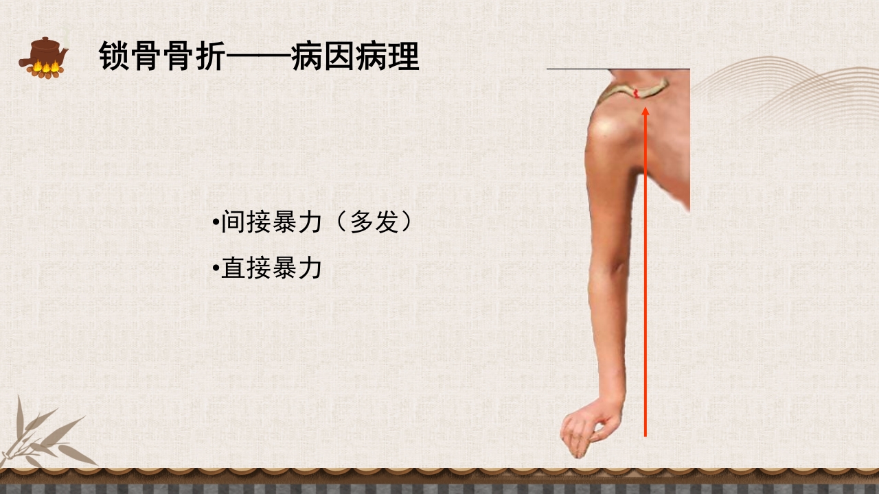 中医伤科上肢骨折护理查房PPT课件8