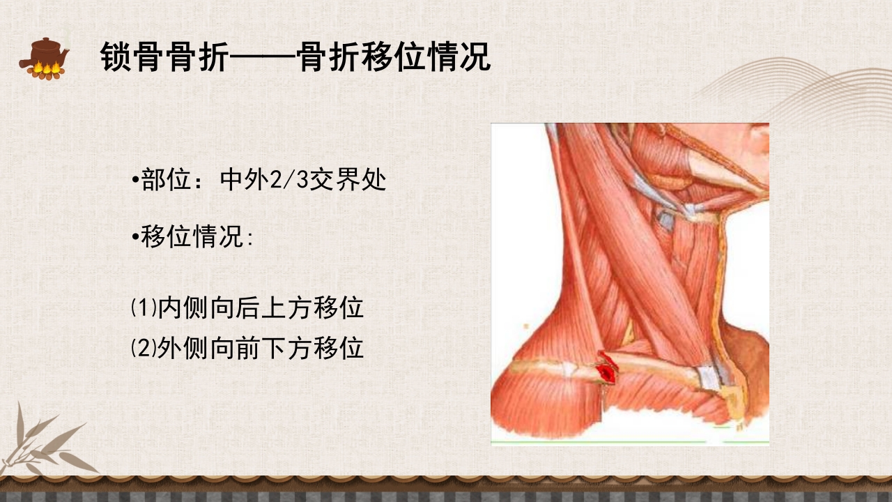 中医伤科上肢骨折护理查房PPT课件9
