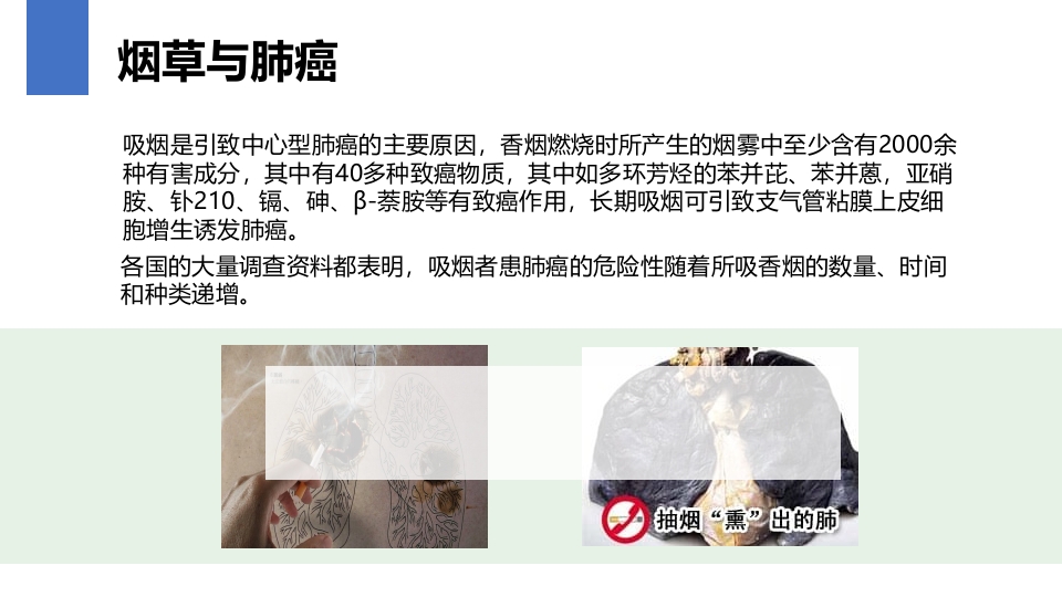 肺癌的早期诊断与防治PPT课件7
