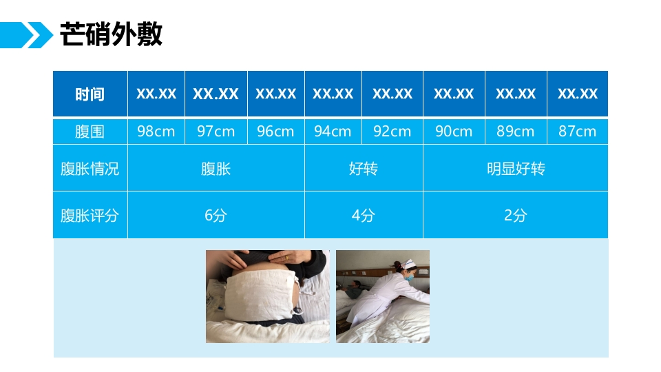 肺癌腹膜转移患者个案护理查房PPT课件11