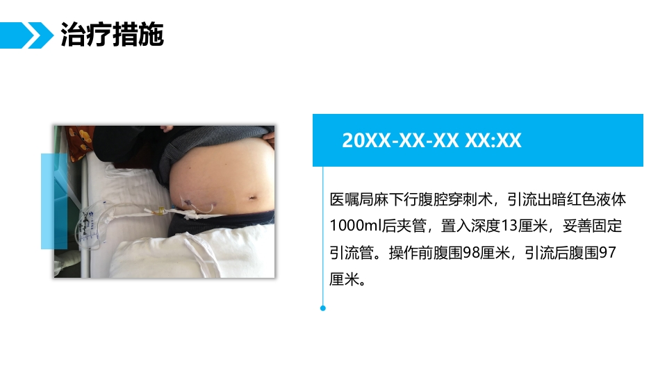 肺癌腹膜转移患者个案护理查房PPT课件8