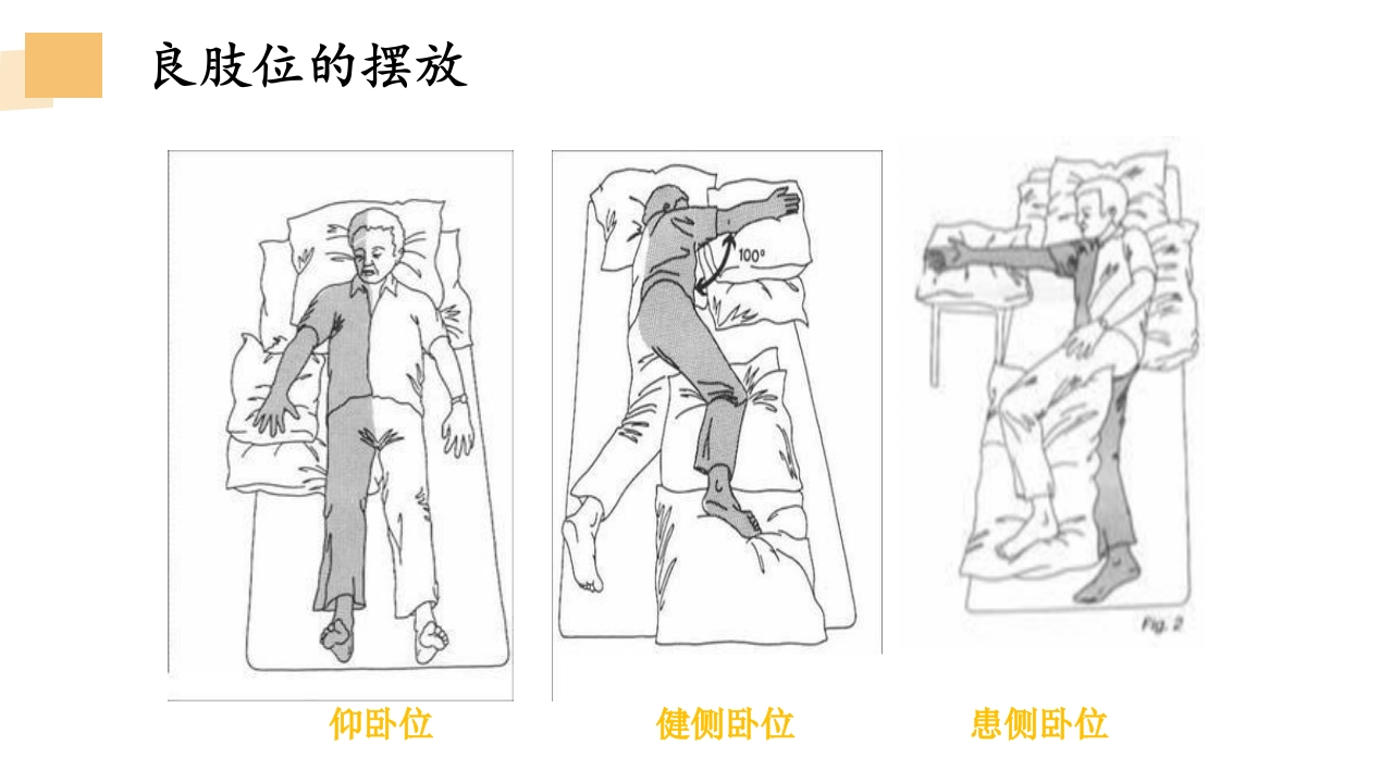 一例卒中后情绪障碍患者的病例讨论PPT课件19