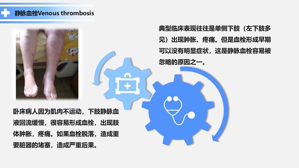 卧床病人常见并发症及护理要点ppt课件11