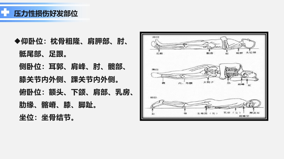 卧床病人常见并发症及护理要点ppt课件6