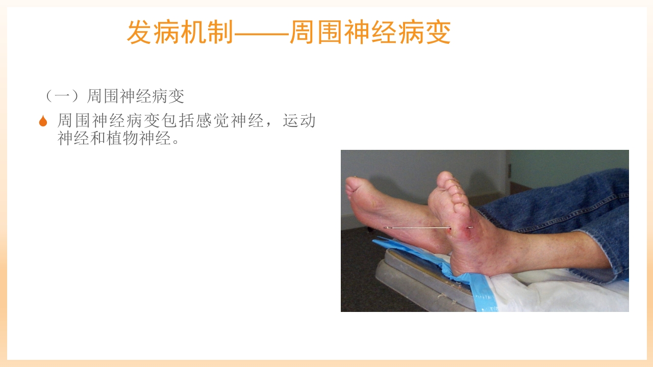 糖尿病足治疗与护理PPT课件10