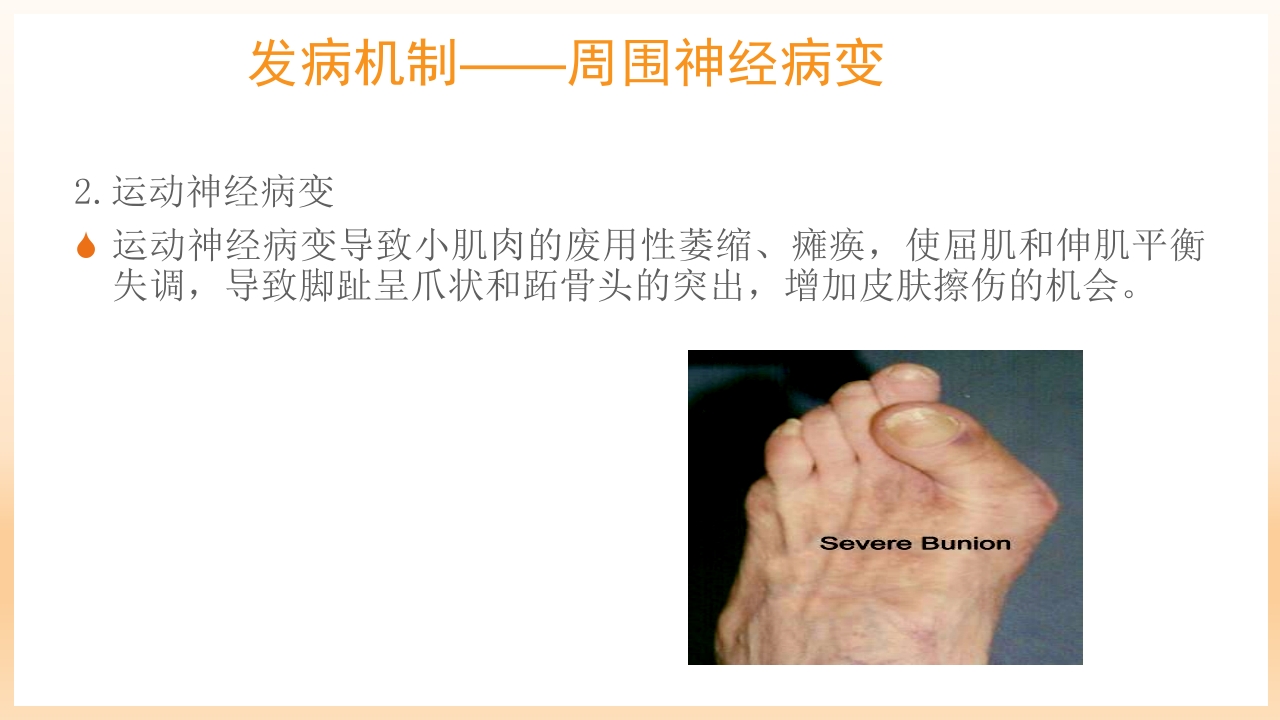 糖尿病足治疗与护理PPT课件12