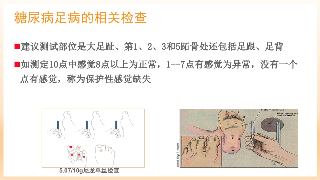 糖尿病足治疗与护理PPT课件23
