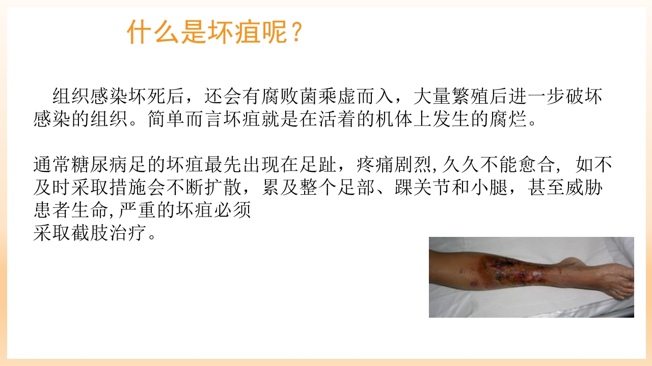 糖尿病足治疗与护理PPT课件45