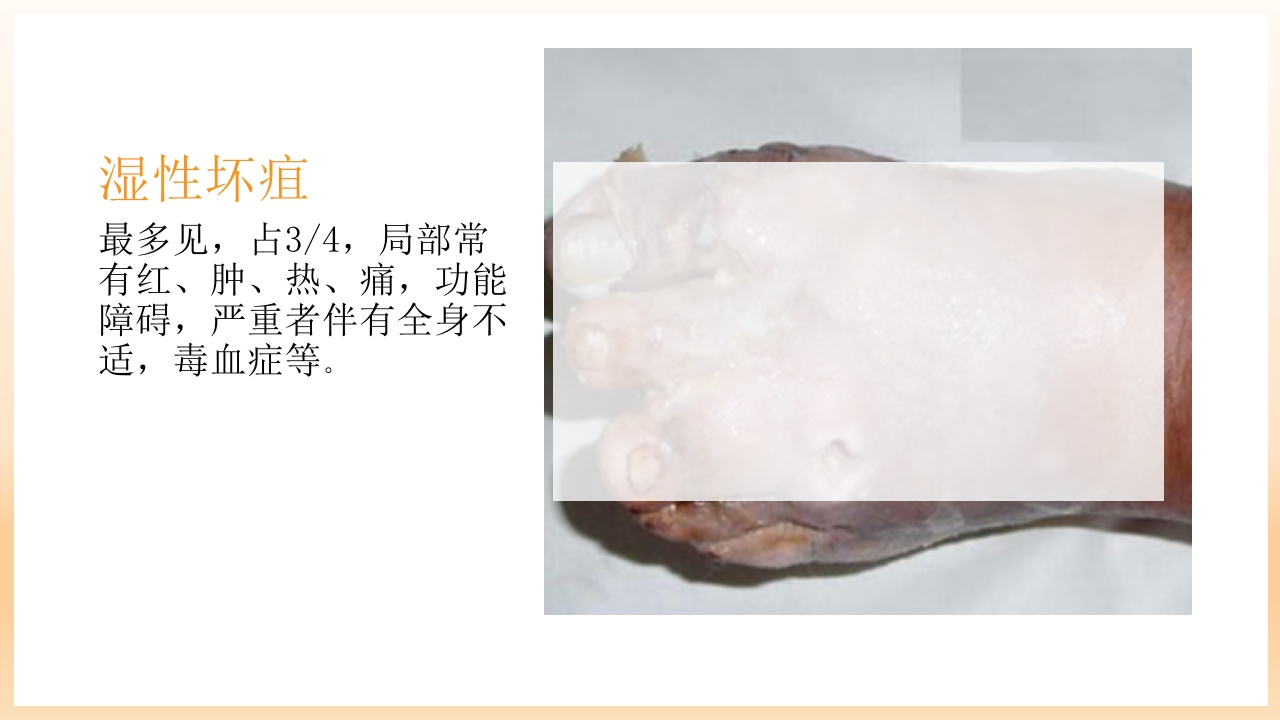 糖尿病足治疗与护理PPT课件47