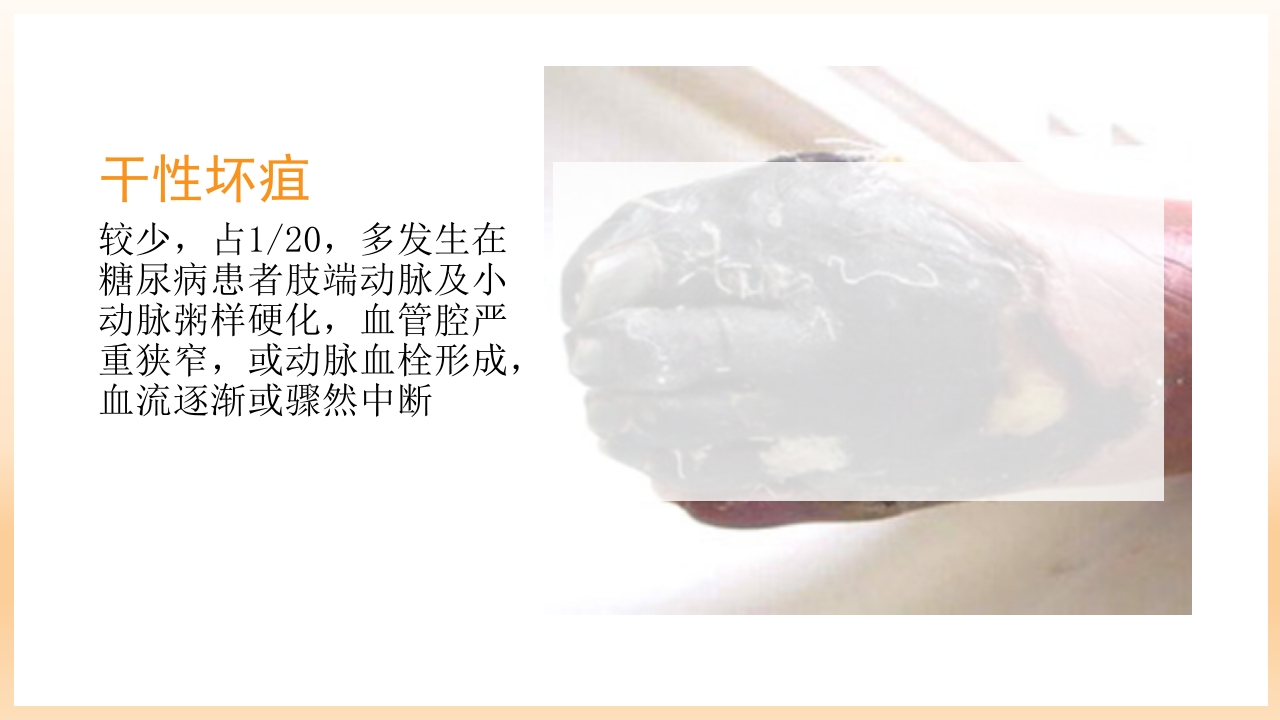 糖尿病足治疗与护理PPT课件48