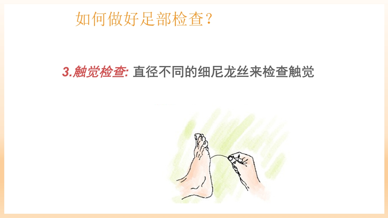 糖尿病足治疗与护理PPT课件67