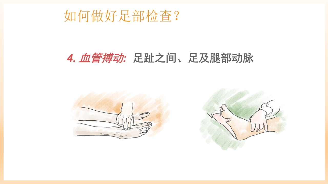 糖尿病足治疗与护理PPT课件68