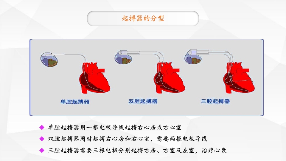 永久性心脏起搏器置入术ppt课件6