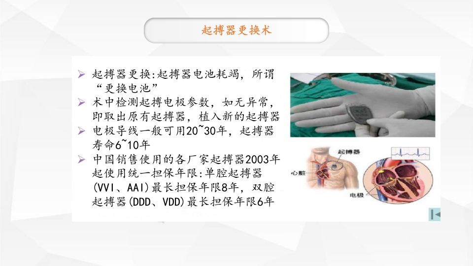 永久性心脏起搏器置入术ppt课件9