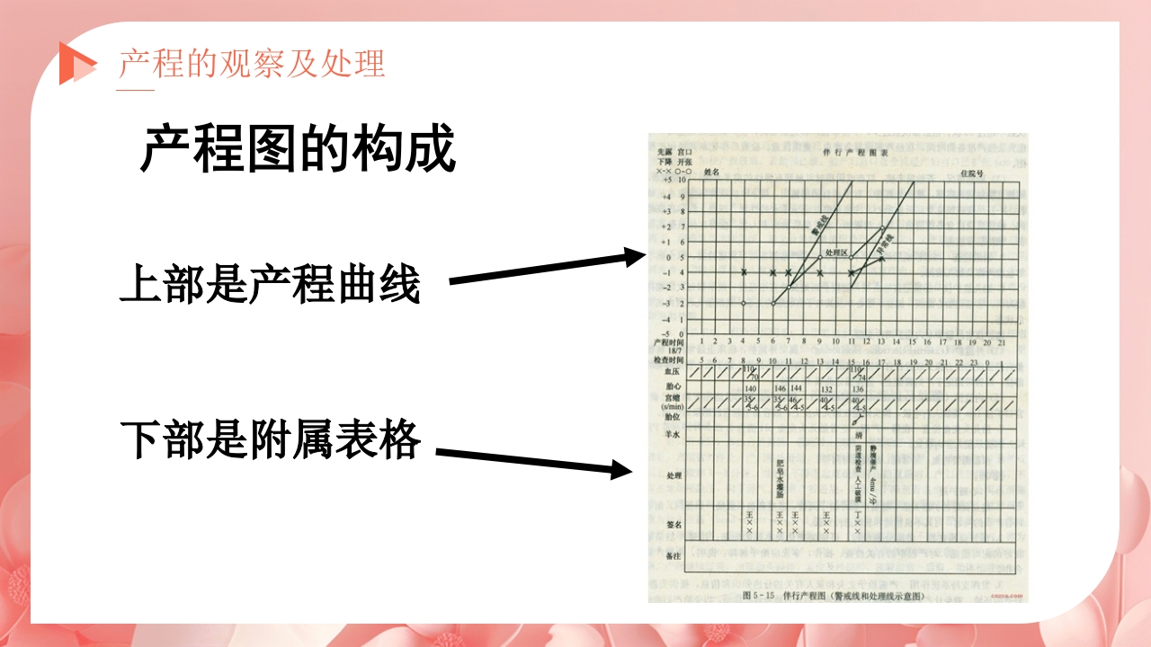产程的观察及处理ppt课件13