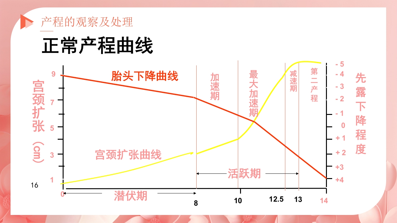 产程的观察及处理ppt课件16